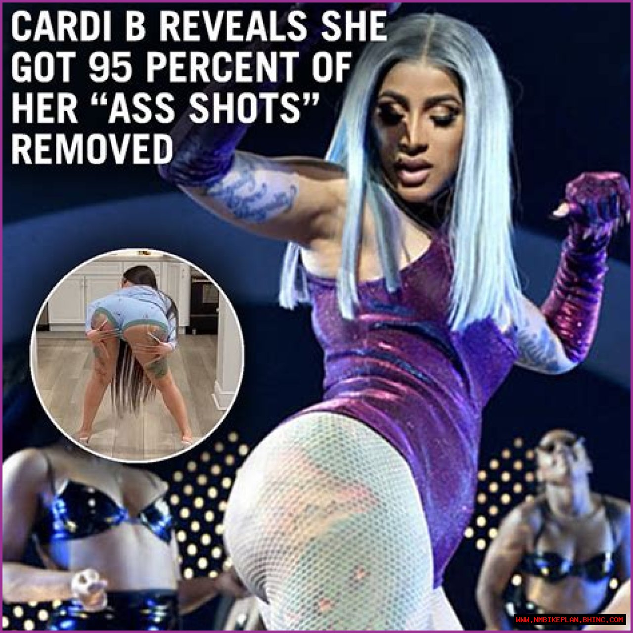 Cardi B Reveals She Had '95 Percent' Of Her Ass Shots Removed