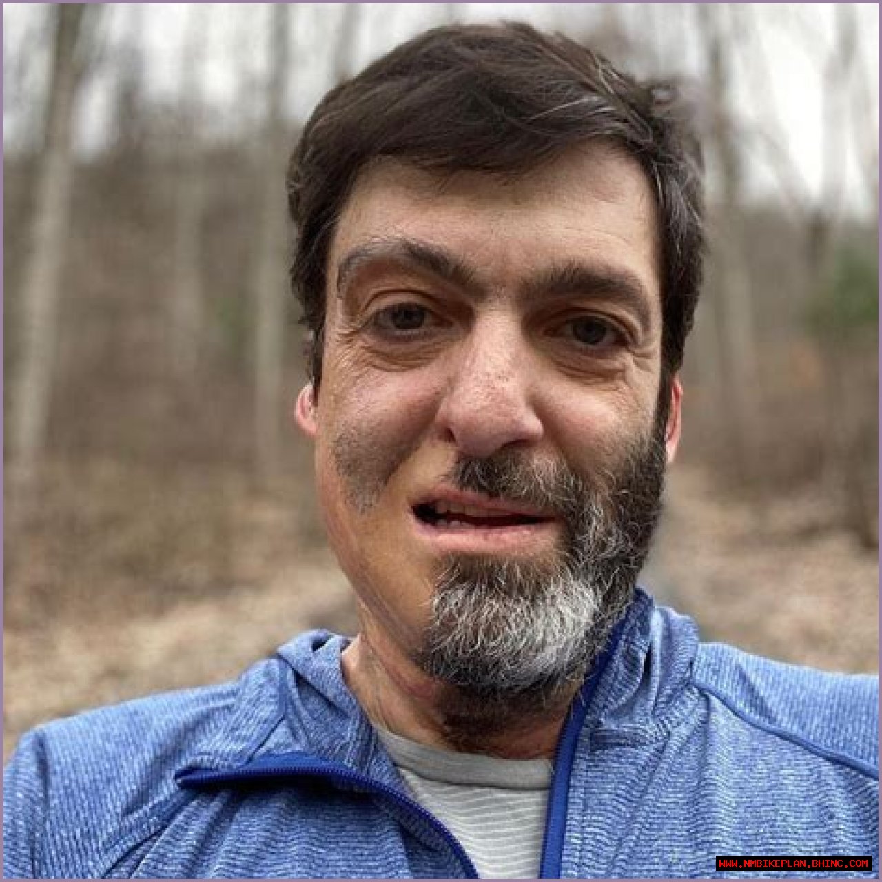 Dan Ariely's Beard — The Accident That Left Him With Half a Beard