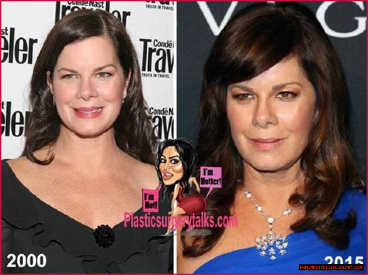 Marcia Gay Harden Plastic Surgery Before and After